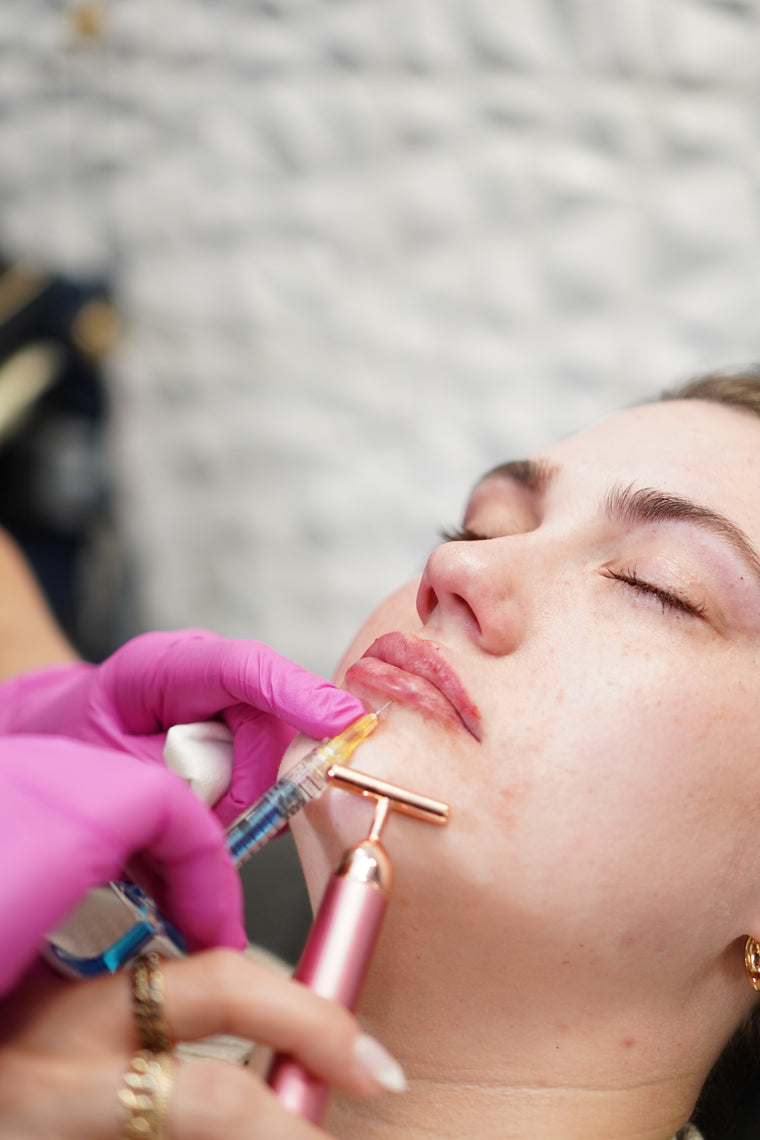 Dermal Fillers