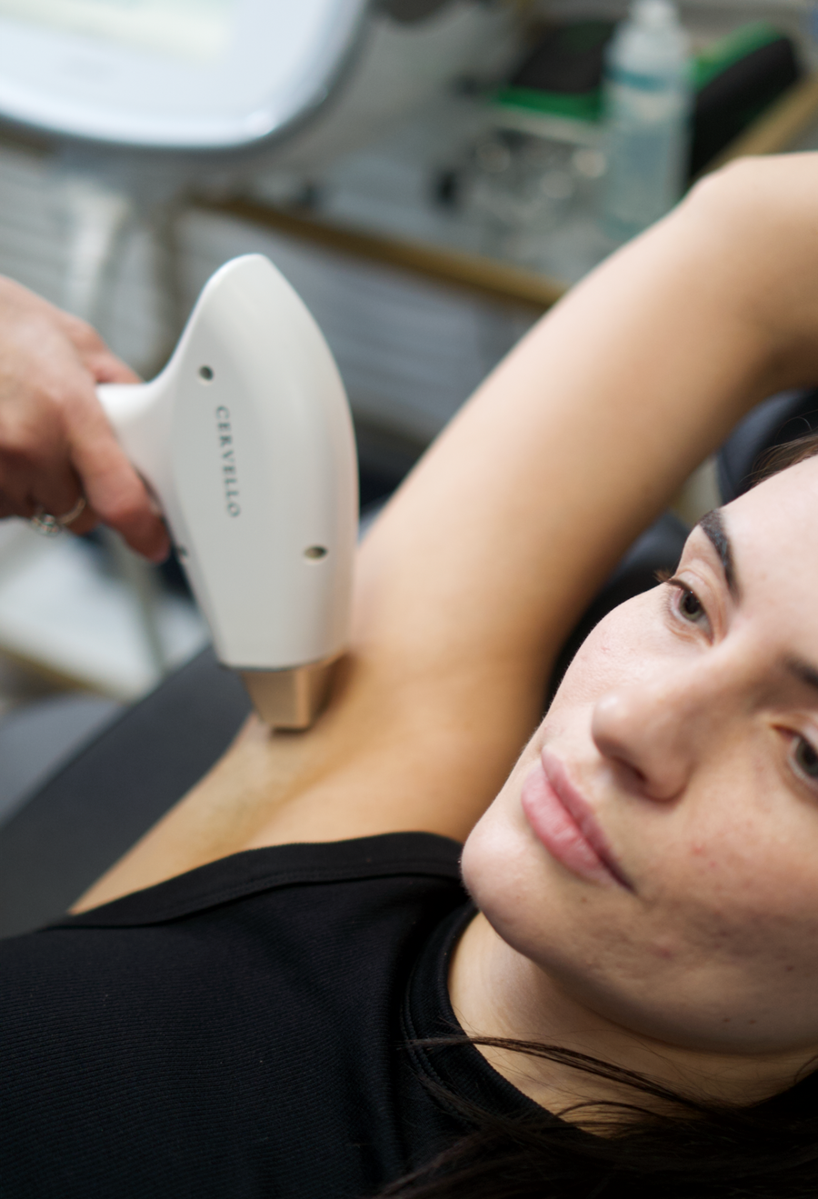 Laser Hair Removal